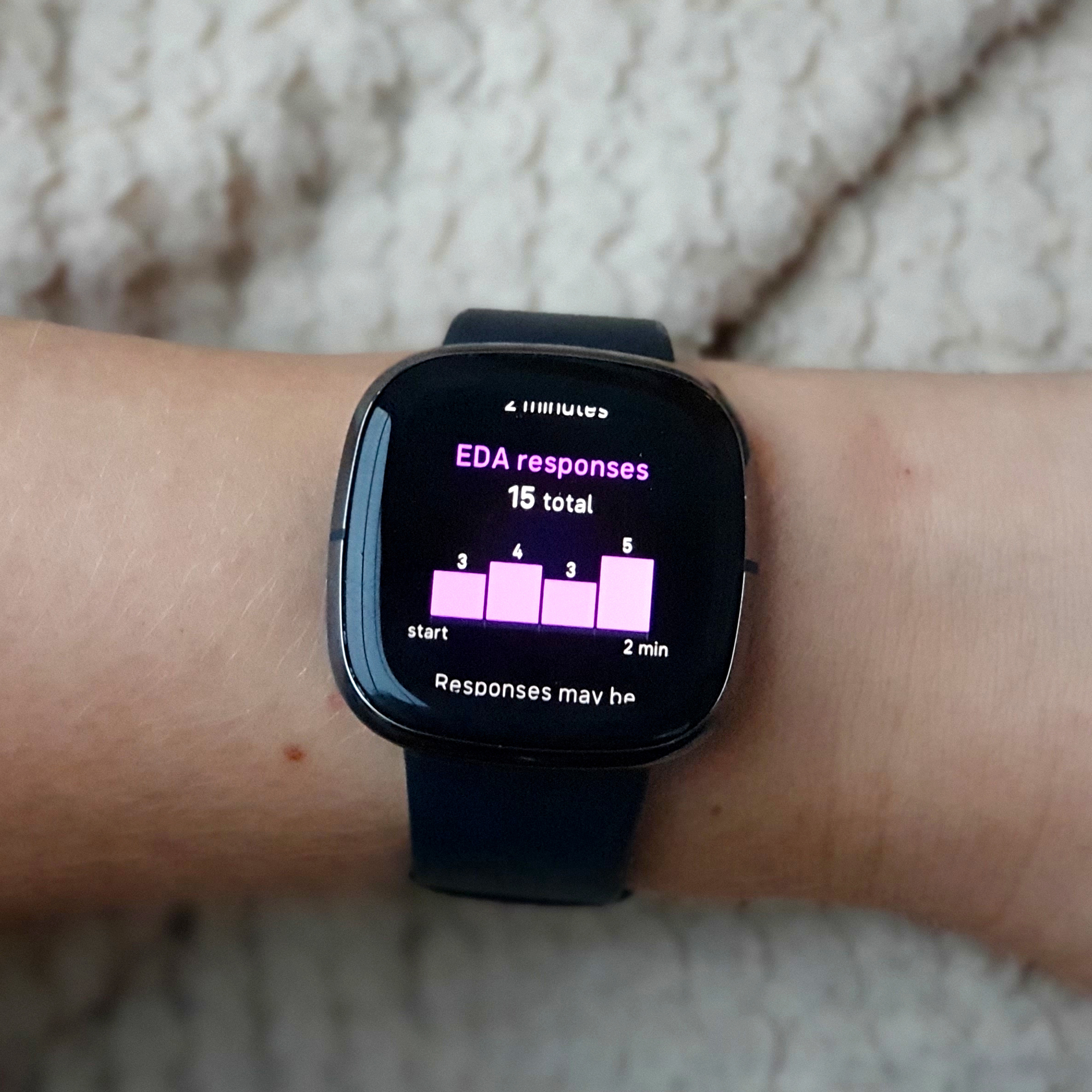 Fitbit Sense nutikell